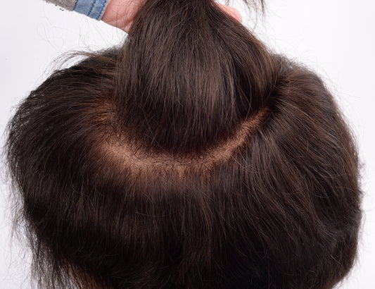 Protesi Capillare Uomo Pelle Sottile (Skin)